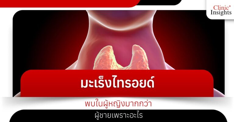 มะเร็งไทรอยด์ พบในผู้หญิงมากกว่าผู้ชายเพราะอะไร