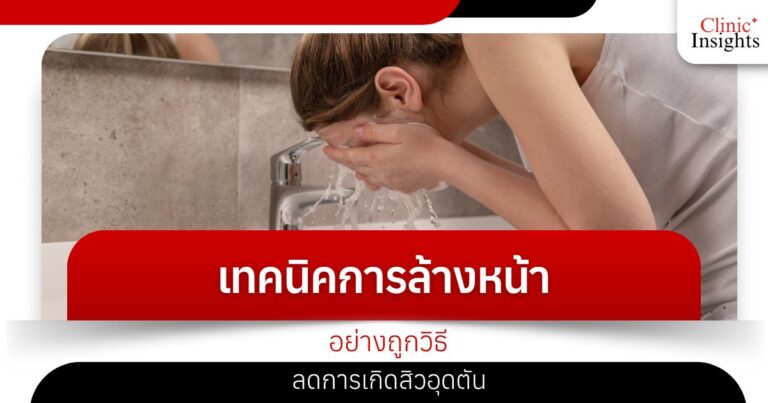 เทคนิคการล้างหน้าอย่างถูกวิธี ลดการเกิดสิวอุดตัน​