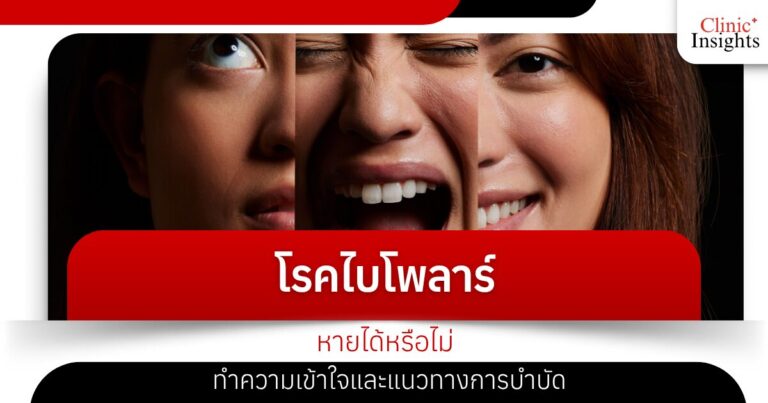 โรคไบโพลาร์ หายได้หรือไม่ ทำความเข้าใจและแนวทางการบำบัด