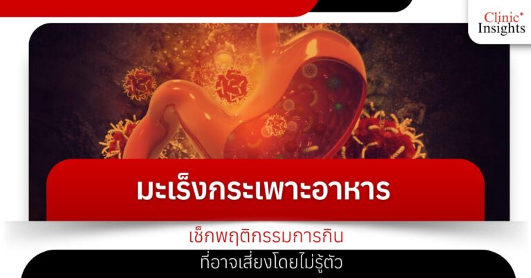 มะเร็งกระเพาะอาหาร เช็กพฤติกรรมการกิน ที่อาจเสี่ยงโดยไม่รู้ตัว