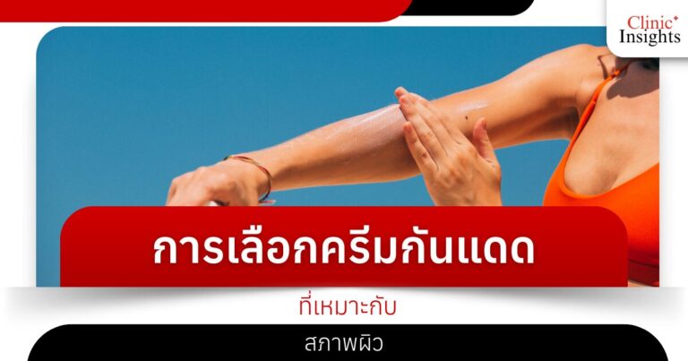 การเลือกครีมกันแดดที่เหมาะกับสภาพผิว​