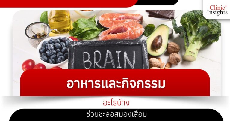 อาหารและกิจกรรมอะไรบ้าง ช่วยชะลอสมองเสื่อม