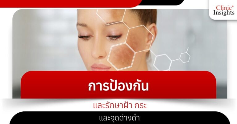 การป้องกันและรักษาฝ้า กระ และจุดด่างดำ