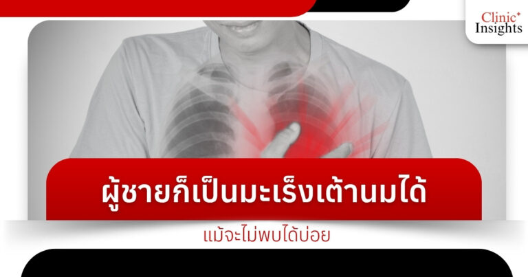 ผู้ชายก็เป็นมะเร็งเต้านมได้ แม้จะไม่พบได้บ่อย