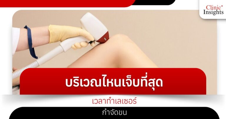 บริเวณไหนเจ็บที่สุดเวลาทำเลเซอร์กำจัดขน