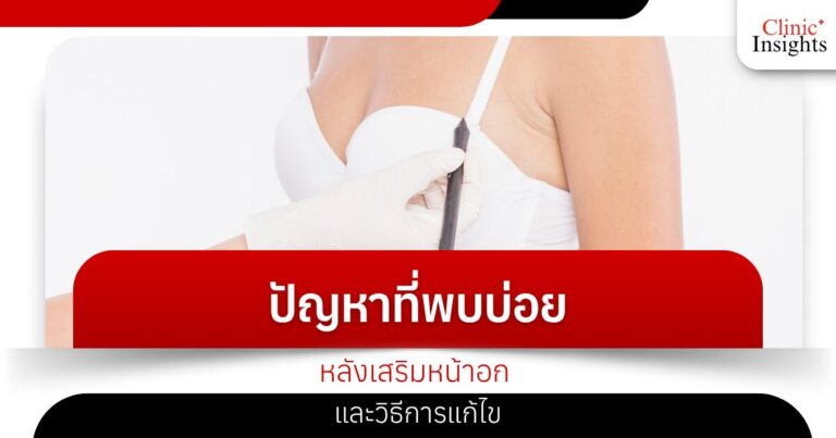 ปัญหาที่พบบ่อยหลังเสริมหน้าอก และวิธีการแก้ไข