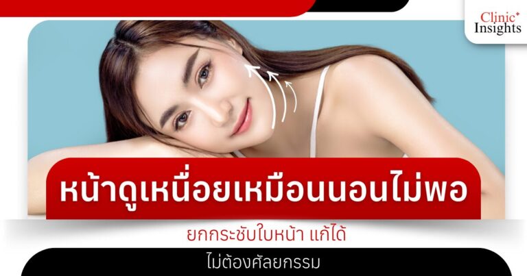 หน้าดูเหนื่อยเหมือนนอนไม่พอ ยกกระชับใบหน้าแก้ได้ ไม่ต้องศัลยกรรม