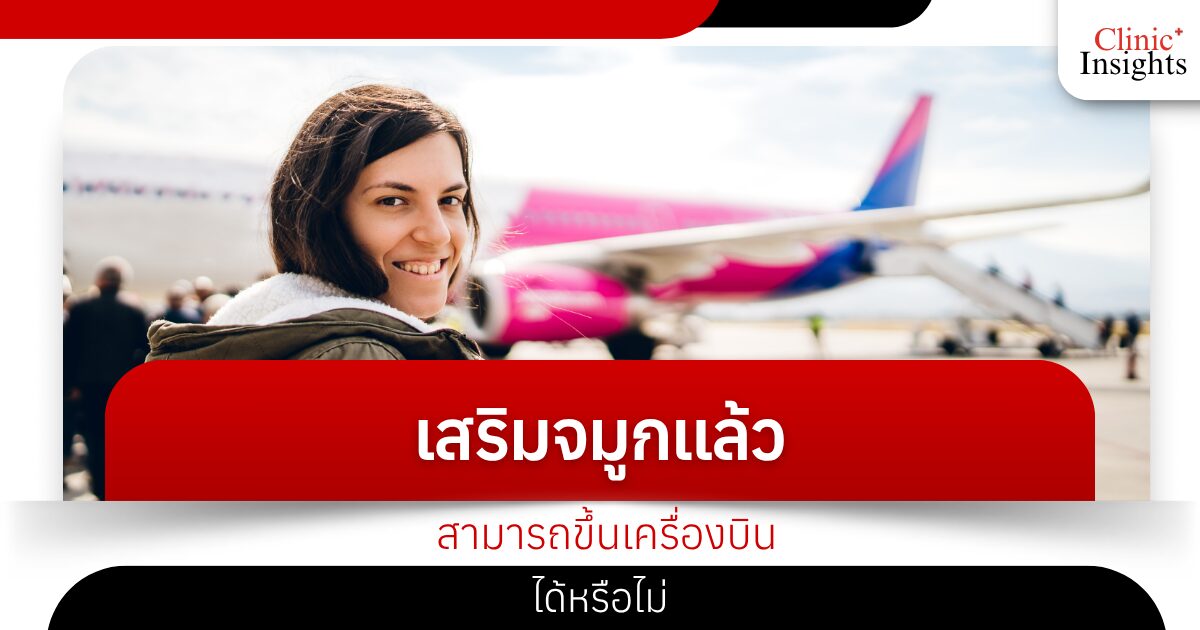 After a nose job, can I board a plane