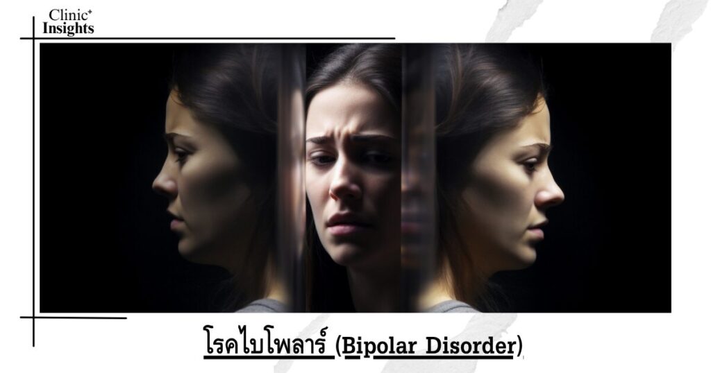 โรคไบโพลาร์ (Bipolar Disorder)