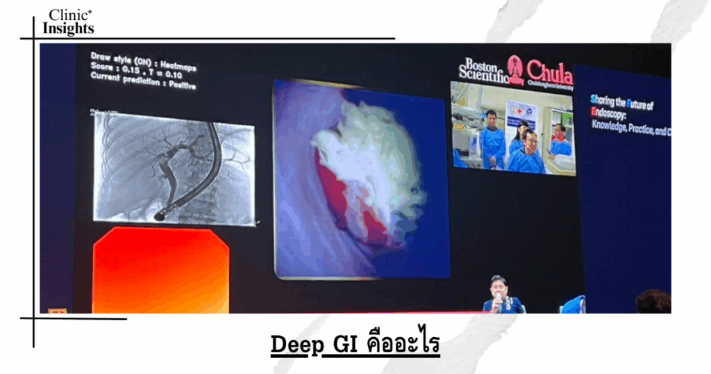 What is Deep GI?