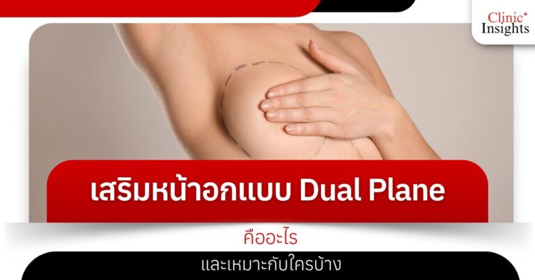 เสริมหน้าอกแบบ Dual Plane คืออะไร และเหมาะกับใครบ้าง