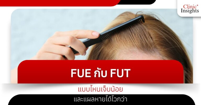 FUE กับ FUT แบบไหนเจ็บน้อยและแผลหายได้ไวกว่า