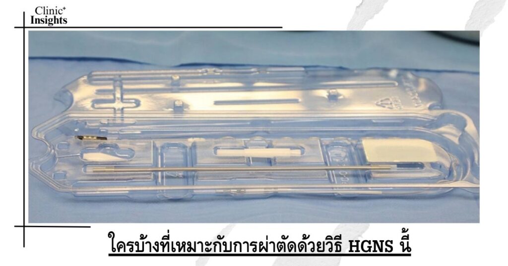 ใครบ้างที่เหมาะกับการผ่าตัดด้วยวิธี HGNS นี้