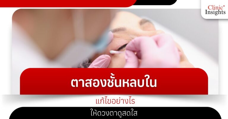 How to fix sunken double eyelids to make your eyes look brighter