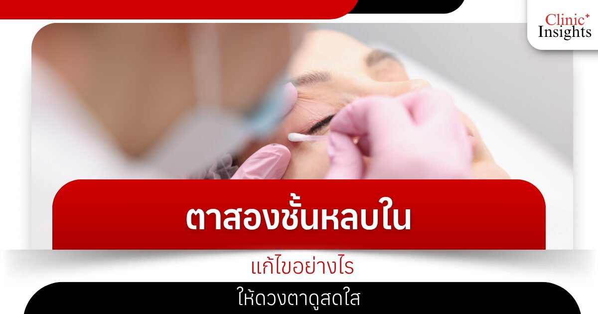 How to fix sunken double eyelids to make your eyes look brighter