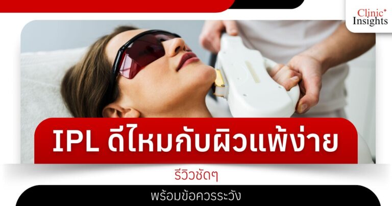 IPL ดีไหมกับผิวแพ้ง่าย รีวิวชัดๆ พร้อมข้อควรระวัง