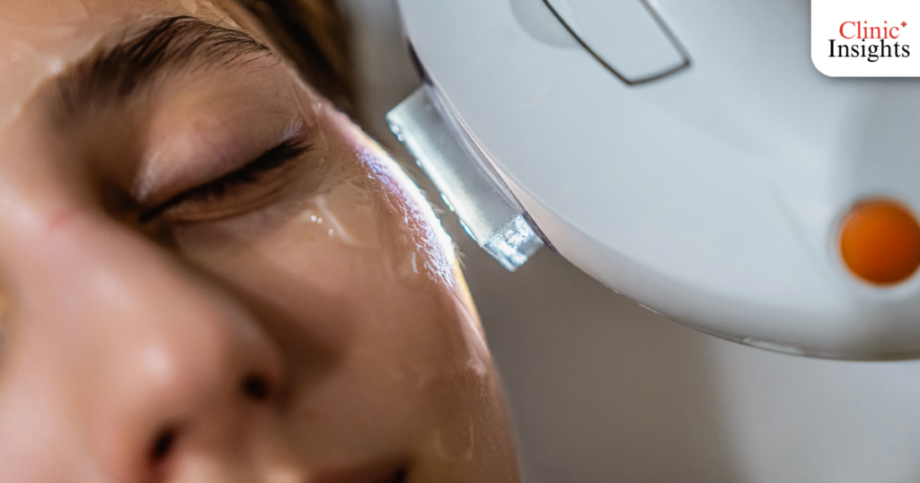 IPL (Intense Pulsed Light) - พลังงานแสงบำบัด