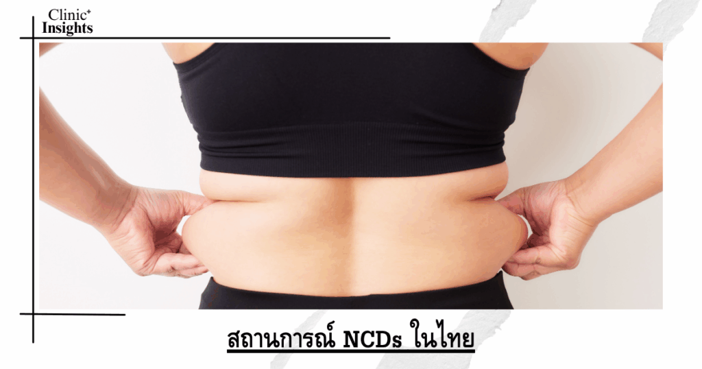 NCD situation in Thailand