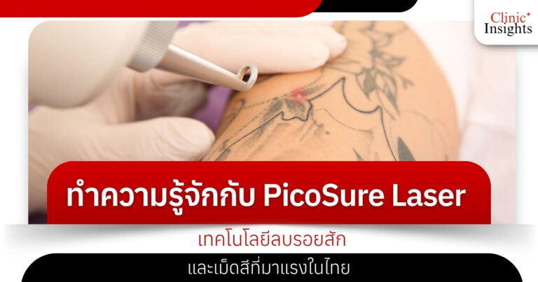 ทำความรู้จักกับ PicoSure Laser เทคโนโลยีลบรอยสักและเม็ดสีที่มาแรงในไทย​