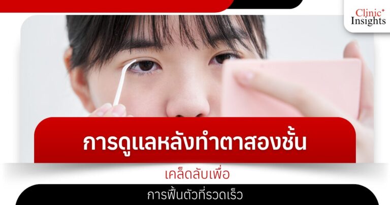 Post-Eyelid Care Tips for a Fast Recovery