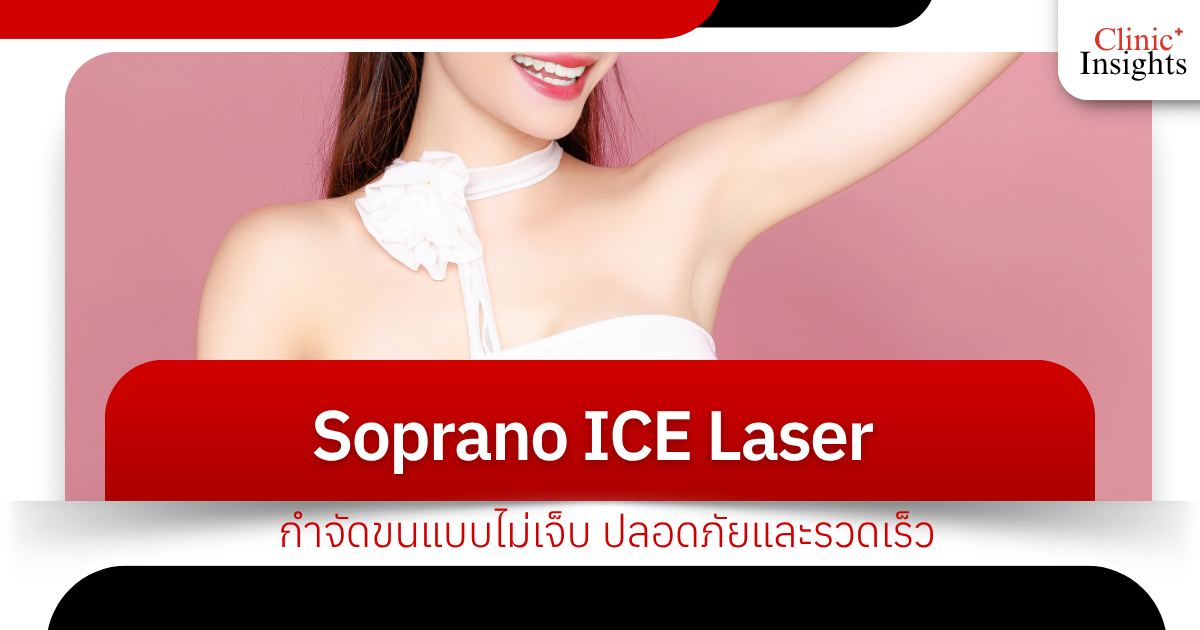Soprano ICE Laser: Painless, safe, and fast hair removal.
