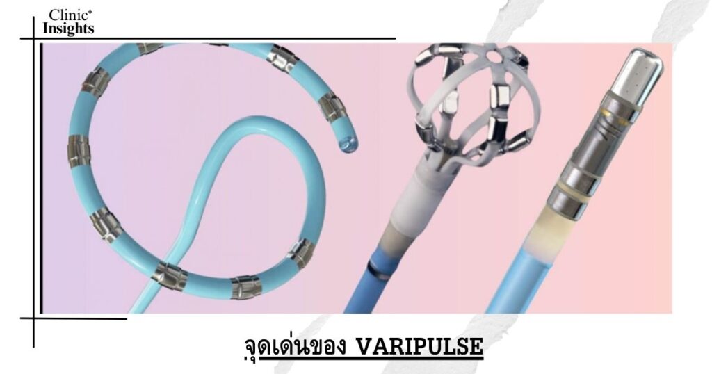 จุดเด่นของ VARIPULSE