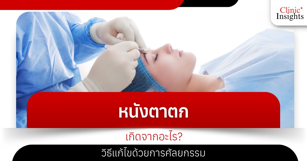 What causes ptosis How to fix it with surgery