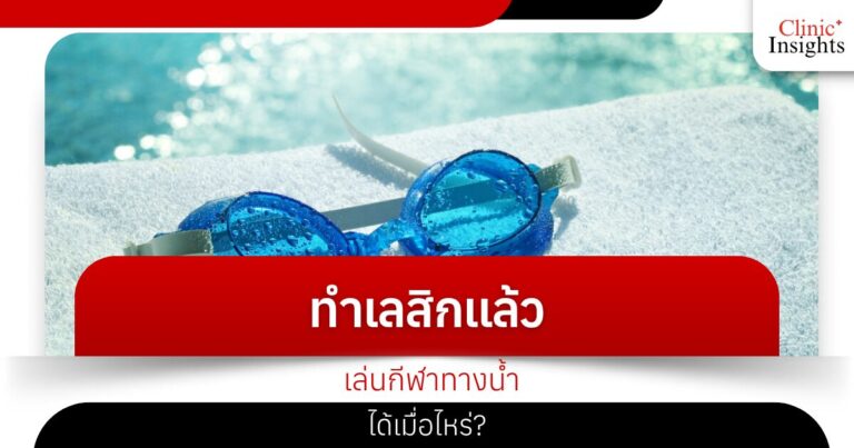 When can I play water sports after having LASIK