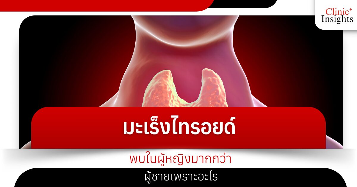 มะเร็งไทรอยด์ พบในผู้หญิงมากกว่าผู้ชายเพราะอะไร