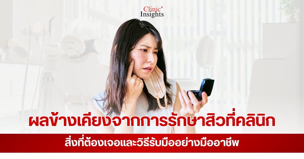 ผลข้างเคียงจากการรักษาสิวที่คลินิก สิ่งที่ต้องเจอและวิธีรับมืออย่างมืออาชีพ