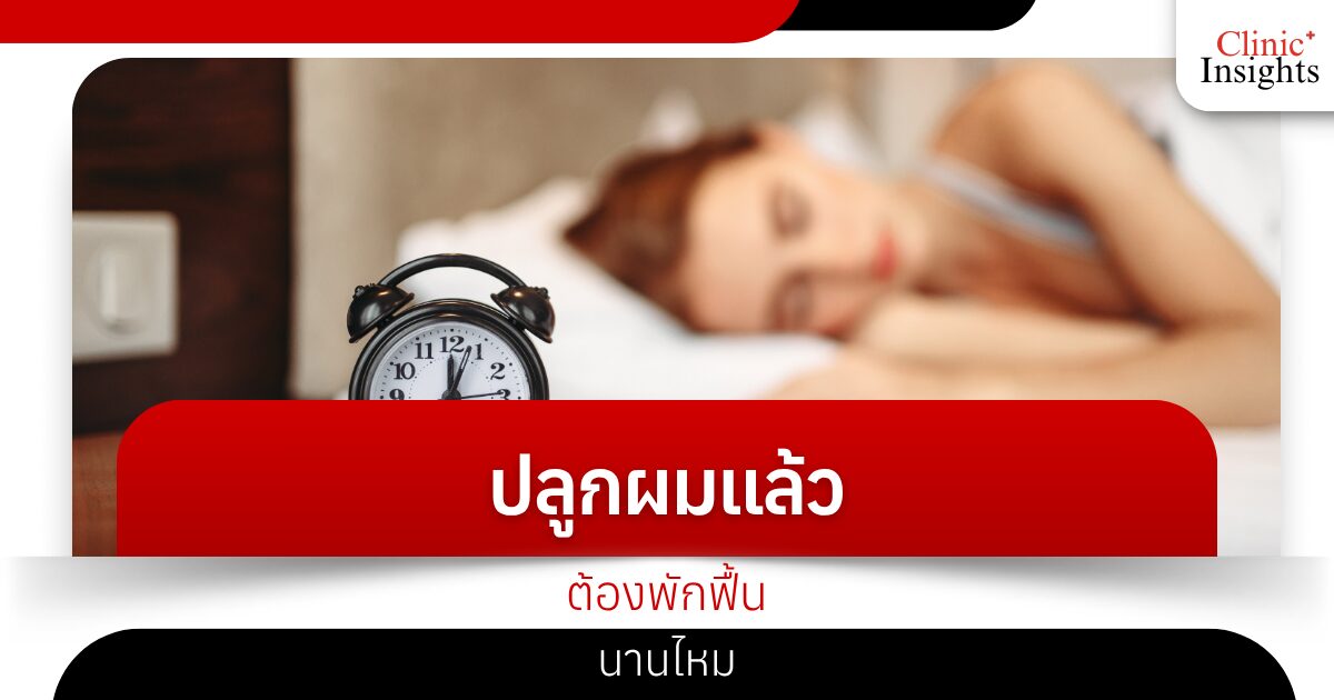 ปลูกผมแล้วต้องพักฟื้นนานไหม