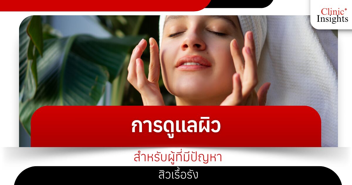 การดูแลผิวสำหรับผู้ที่มีปัญหาสิวเรื้อรัง​