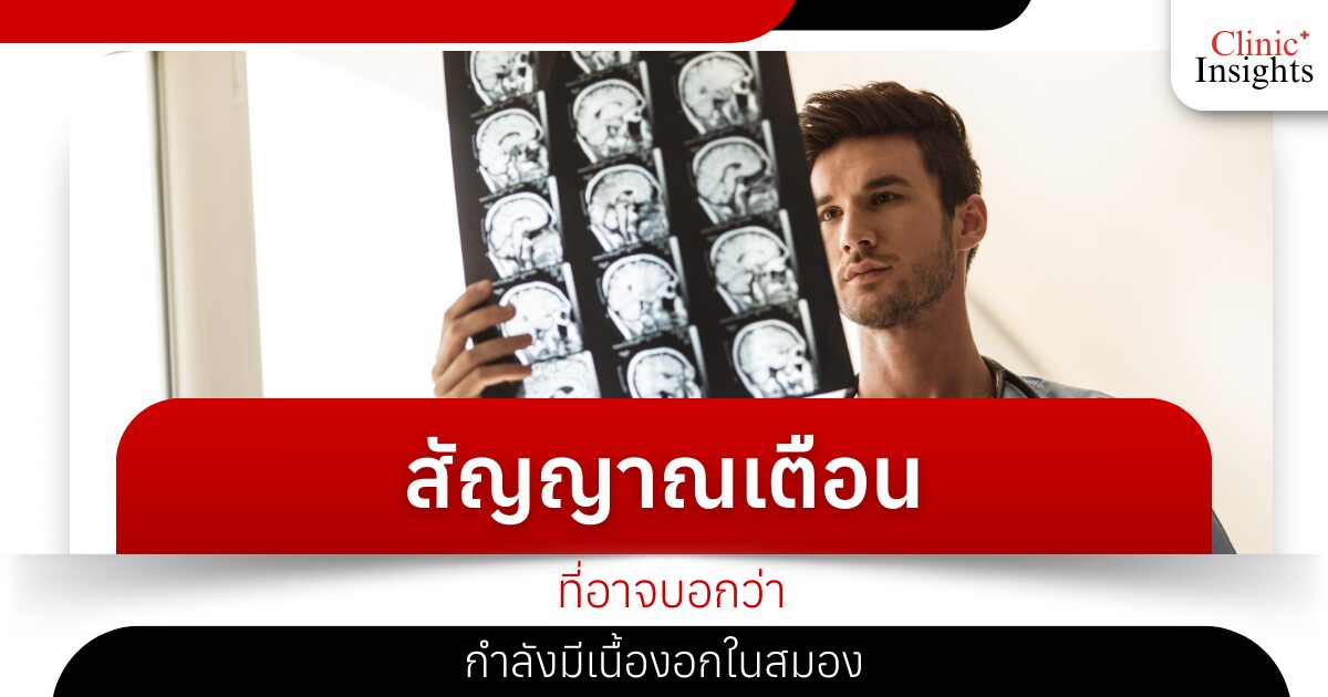 สัญญาณเตือนที่อาจบอกว่ากำลังมีเนื้องอกในสมอง