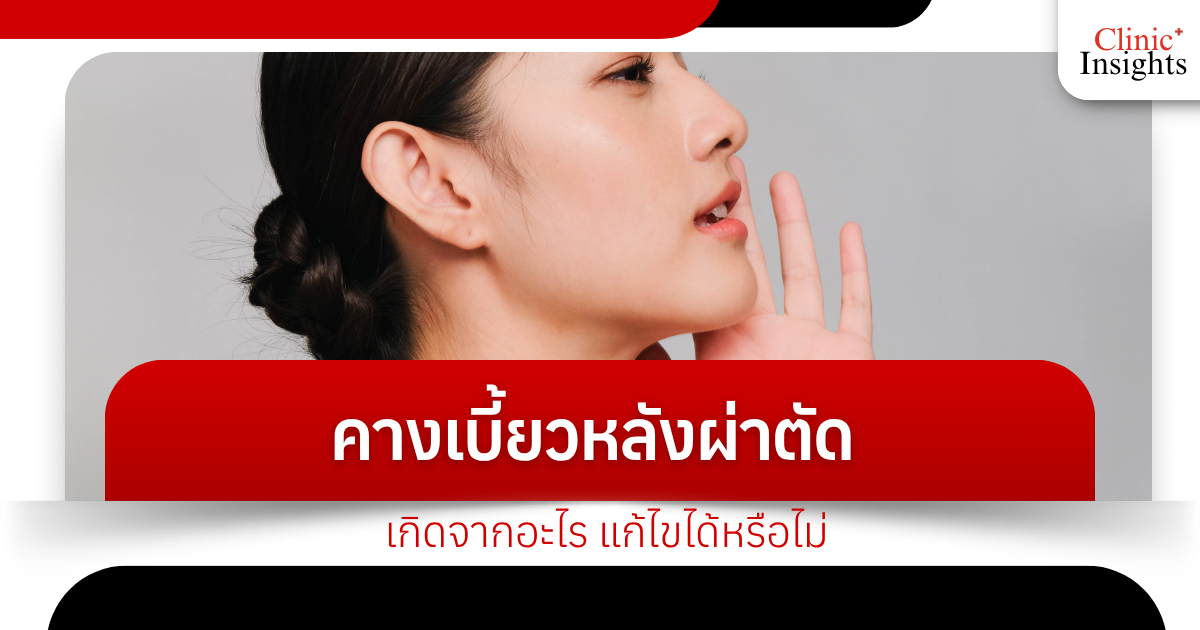 What causes a crooked chin after surgery? Can it be fixed?