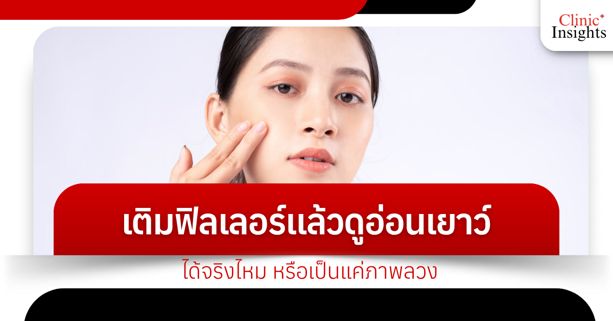 Can fillers really make you look younger? Or is it just an illusion?