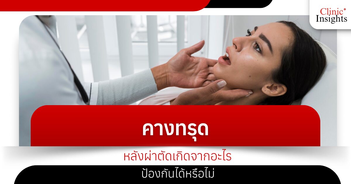 คางทรุดหลังผ่าตัดเกิดจากอะไร ป้องกันได้หรือไม่