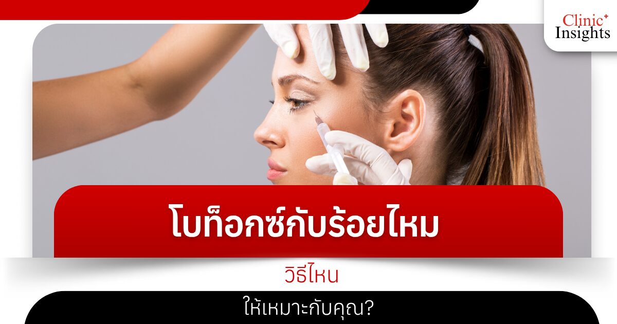 โบท็อกซ์กับร้อยไหม วิธีไหนให้เหมาะกับคุณ