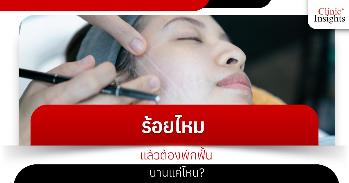 ร้อยไหมแล้วต้องพักฟื้นนานแค่ไหน