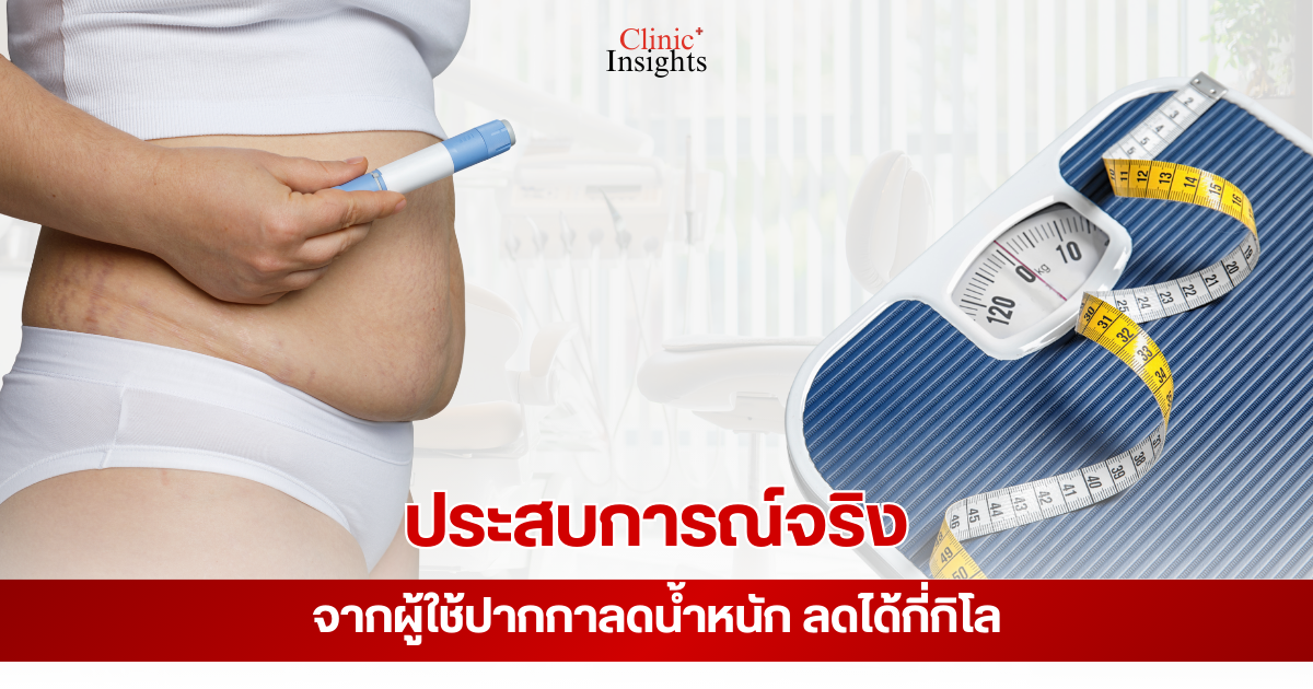 ประสบการณ์จริงจากผู้ใช้ปากกาลดน้ำหนัก ลดได้กี่กิโล