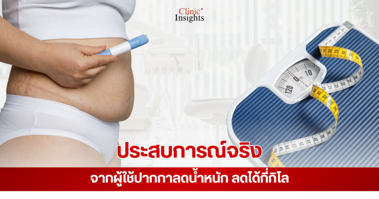 ประสบการณ์จริงจากผู้ใช้ปากกาลดน้ำหนัก ลดได้กี่กิโล
