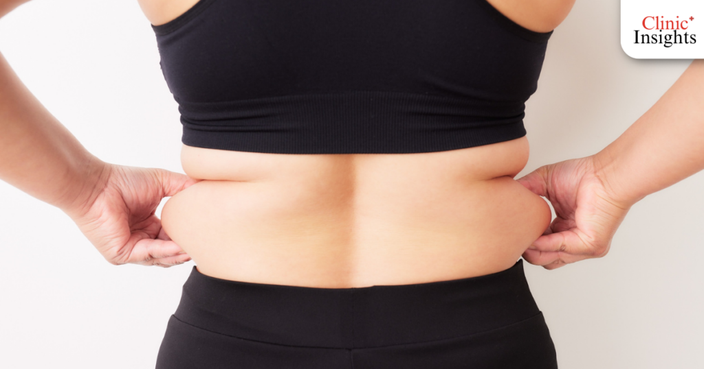 insulin resistance