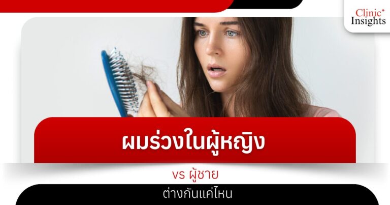 ผมร่วงในผู้หญิง vs ผู้ชาย ต่างกันแค่ไหน