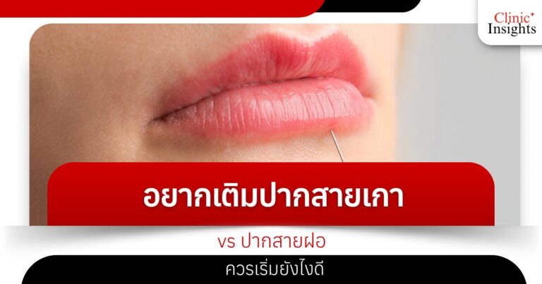 อยากเติมปากสายเกา vs ปากสายฝอ ควรเริ่มยังไงดี