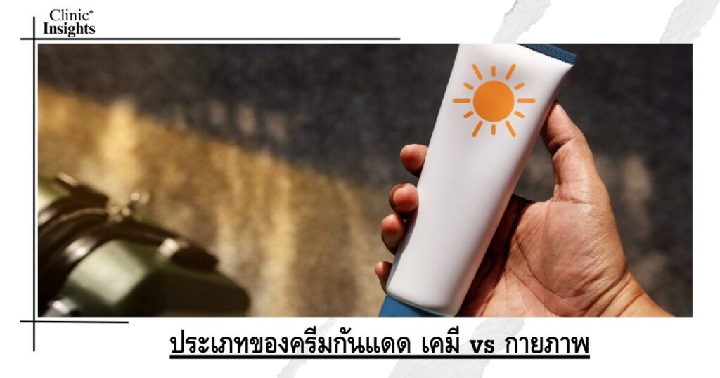 ประเภทของครีมกันแดด เคมี vs กายภาพ