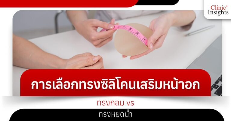 การเลือกทรงซิลิโคนเสริมหน้าอก ทรงกลม vs ทรงหยดน้ำ​