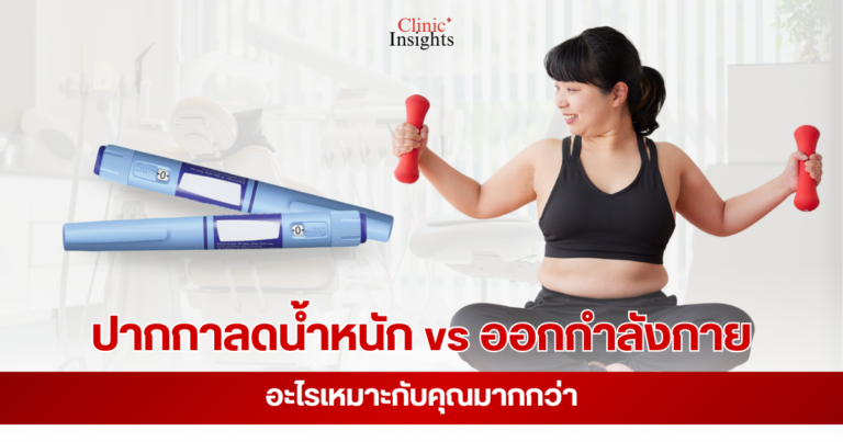 เปรียบเทียบ ปากกาลดน้ำหนัก vs ออกกำลังกาย วิธีไหนเหมาะกับคุณ