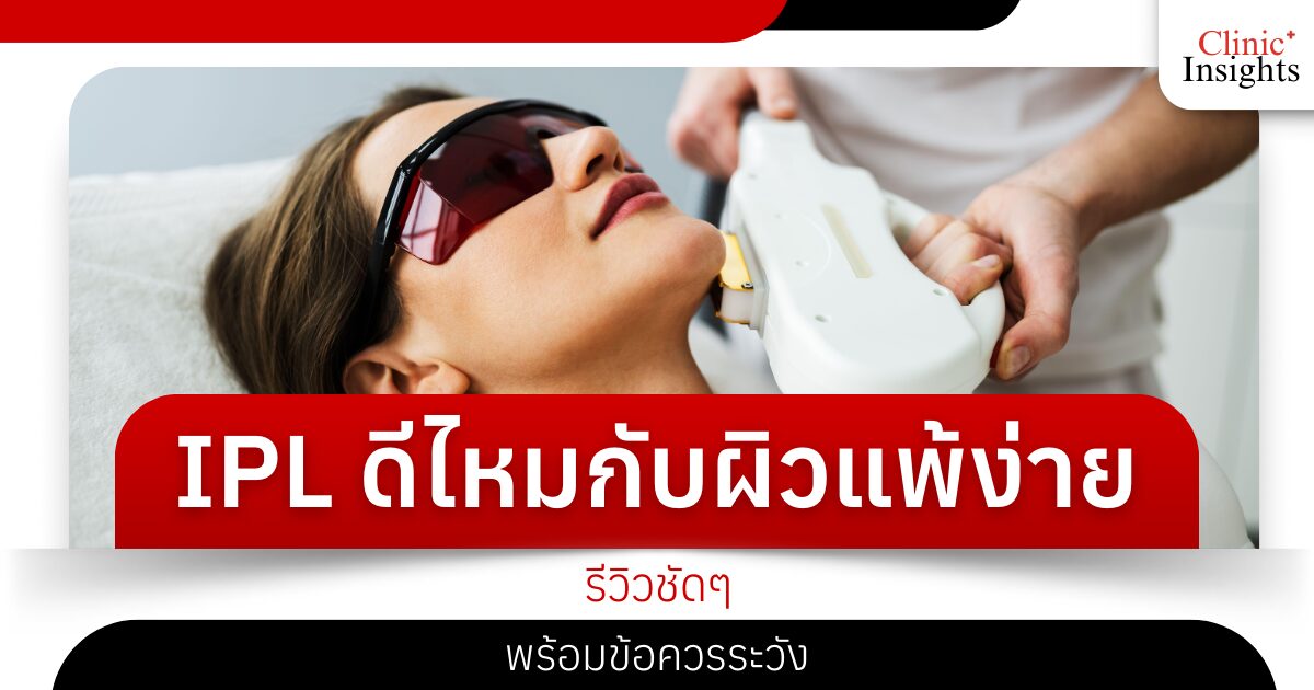 IPL ดีไหมกับผิวแพ้ง่าย รีวิวชัดๆ พร้อมข้อควรระวัง