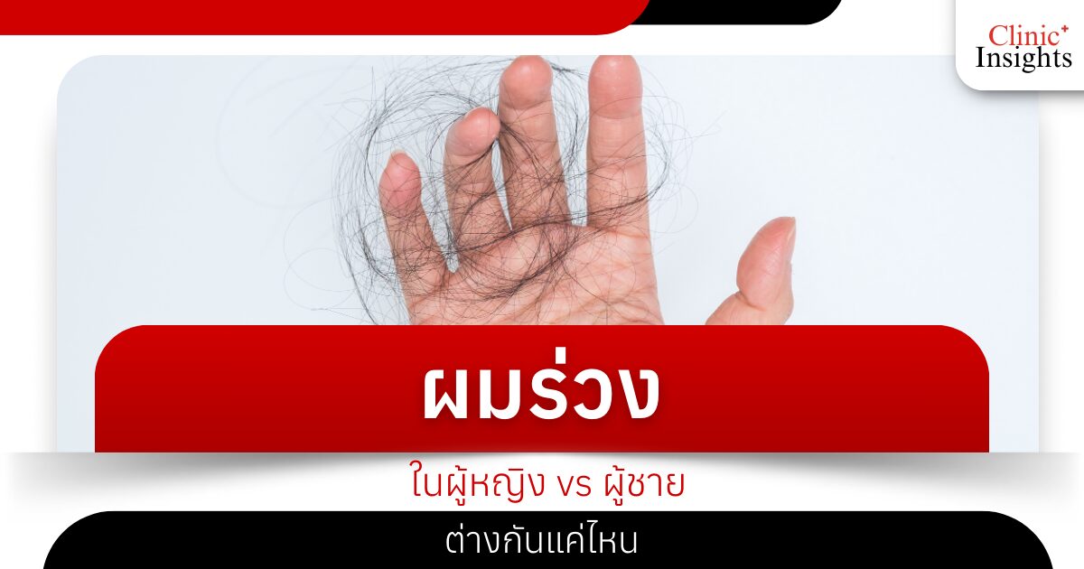 ผมร่วงในผู้หญิง vs ผู้ชาย ต่างกันแค่ไหน