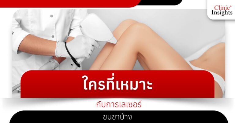 ใครที่เหมาะกับการเลเซอร์ขนขาบ้าง