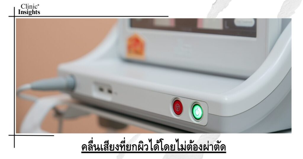 คลื่นเสียงที่ยกผิวได้โดยไม่ต้องผ่าตัด